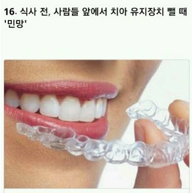 치아교정의 고통 ㄷㄷㄷ.jpg | 인스티즈
