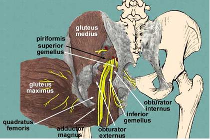 Trochanteric Bursitis : 네이버 블로그